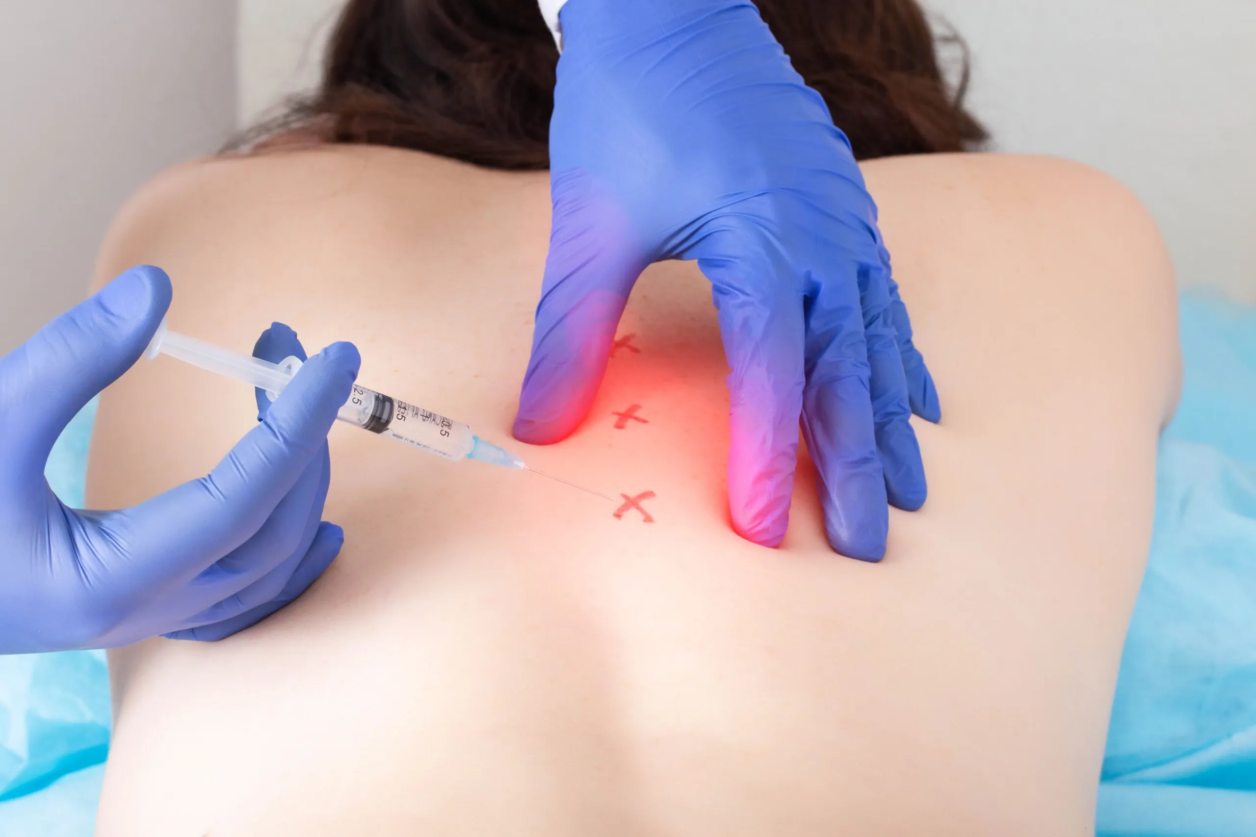 Patient receiving trigger point injection therapy at West Eastern Health in Ponte Vedra Beach, FL near Jacksonville